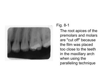 Fig. 8-1 The root apices of the premolars and molars are "cut off ...