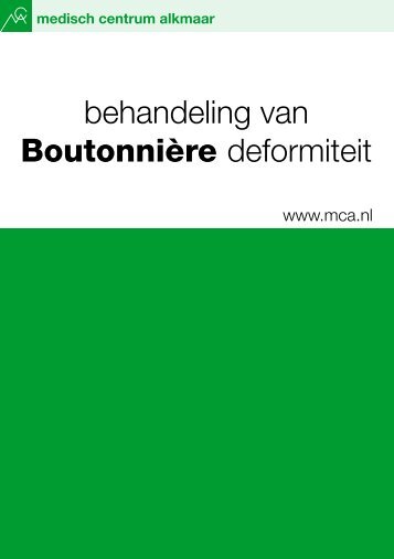 Behandeling van Boutonniére deformiteit - Mca