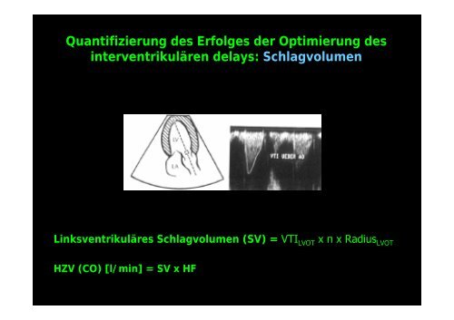 InterventrikulÃ¤res delay - Tschwalm.de