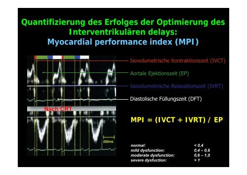 InterventrikulÃ¤res delay - Tschwalm.de