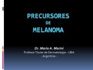 Precursores De melanoma