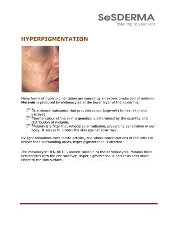 Hyperpigmentation Protocols - Dermavista.com