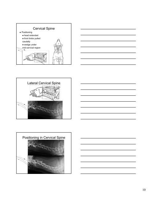 Normal Radiographic Anatomy of the Spinal Column Normal ...