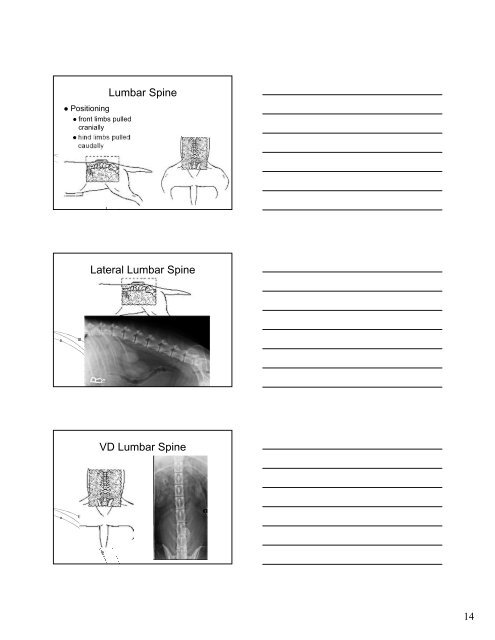 Normal Radiographic Anatomy of the Spinal Column Normal ...