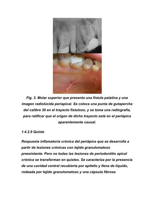 Manual de Endodoncia. PatologÃ­a pulpo- periapical.