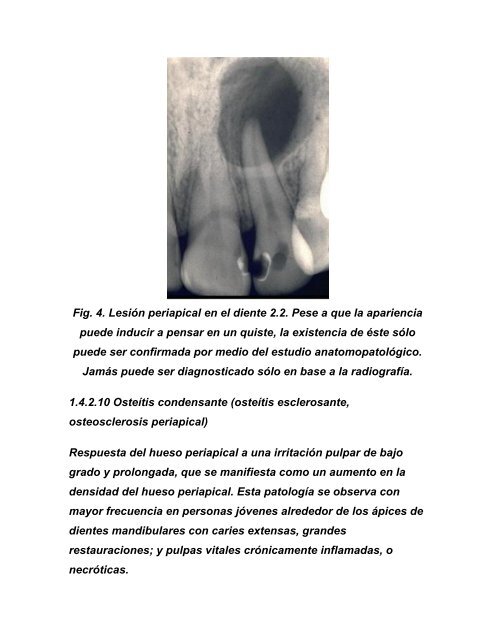 Manual de Endodoncia. PatologÃ­a pulpo- periapical.