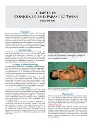 124. Conjoined & Parasitic Twins - Global HELP