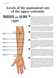 RADIUS and ULNA left