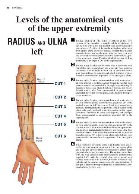 Anatomy Radius And Ulna - Anatomy Drawing Diagram