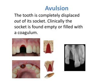 Tooth Trauma Guide.pdf - ProSites
