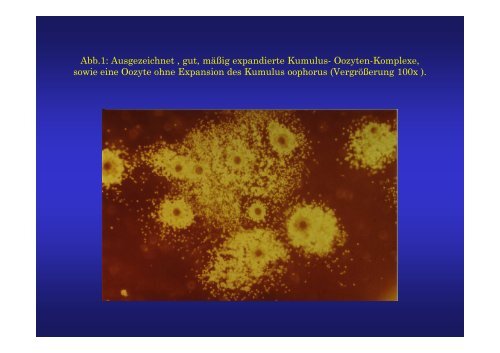 Vortrag Ropeter: In-vitro Maturation - Dragon IVF