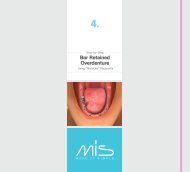 Cemented Bridge Bar Retained Overdenture - Mis Implants