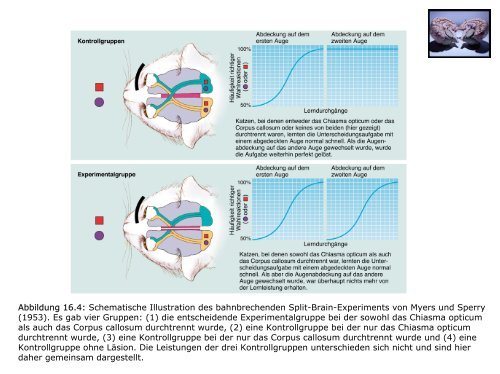 Welche neuropsychologischen Störungsbilder sind nach ...