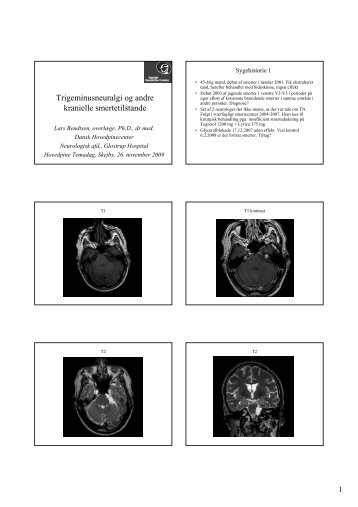 v/ Lars Bendtsen, OverlÃ¦ge, Dr. Med (pdf).