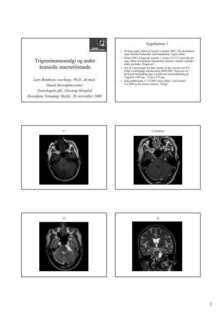 v/ Lars Bendtsen, OverlÃ¦ge, Dr. Med (pdf).