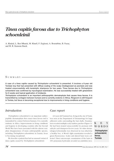 Tinea capitis favosa due to Trichophyton schoenleinii