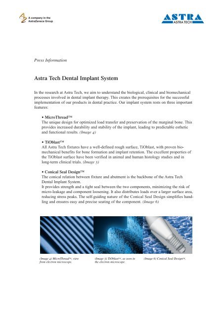 Astra Tech Dental Implant System