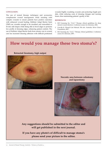 JSTA December 2010 - Australian Association of Stomal Therapy ...