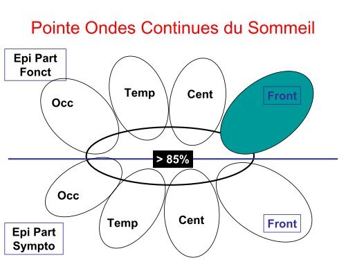 Epilepsie et Sommeil chez l'enfant - SFRMS