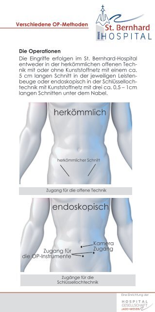 Leistenhernien Patienteninformation - Krankenhaus Brake