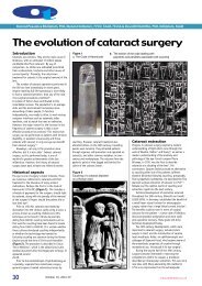 The evolution of cataract surgery - Pesudovs