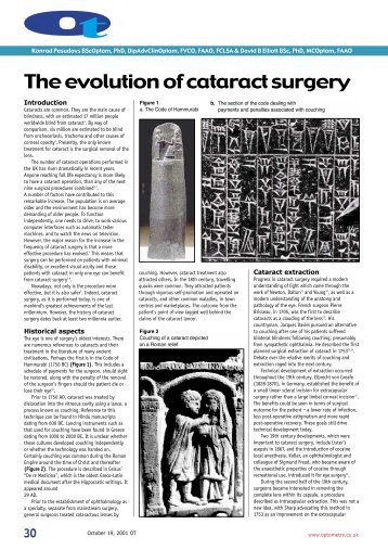 The evolution of cataract surgery - Pesudovs