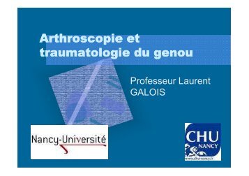 Arthroscopie et traumatologie du genou [Mode de compatibilité]