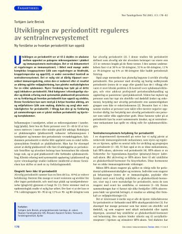 Utviklingen av periodontitt reguleres av sentralnervesystemet