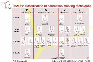 MADS* classification of bifurcation stenting techniques - Bifurc.net