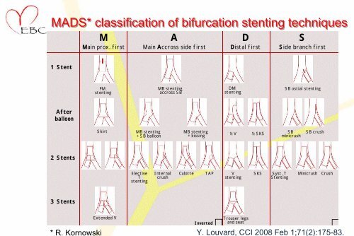 MADS* classification of bifurcation stenting techniques - Bifurc.net