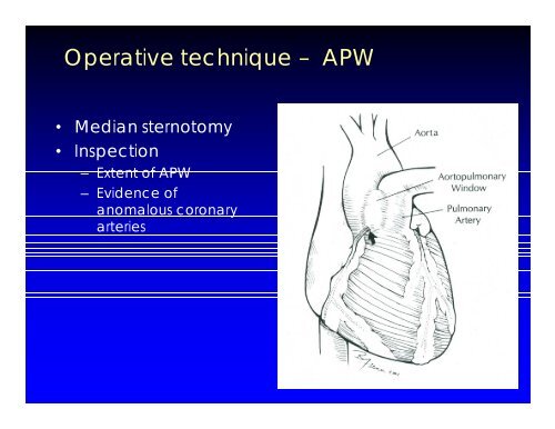 Aortopulmonary Window and Associated Anomalies