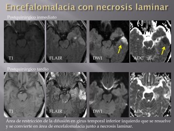 Diapositiva 1