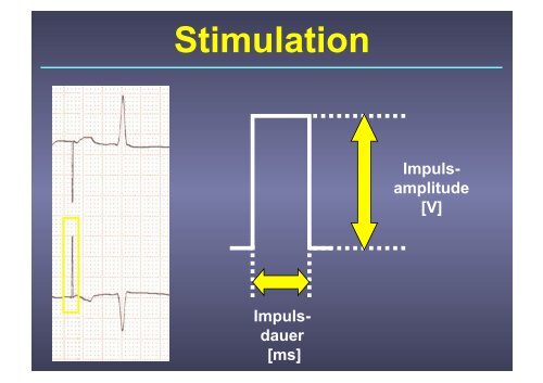 Herzschrittmacher: Basics und EKG-Workshop - Vivantes