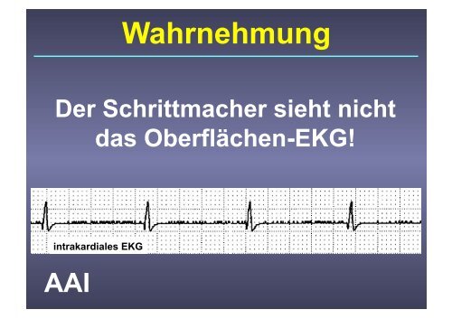 Herzschrittmacher: Basics und EKG-Workshop - Vivantes