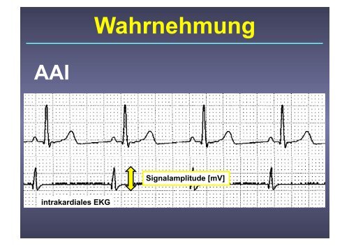 Herzschrittmacher: Basics und EKG-Workshop - Vivantes