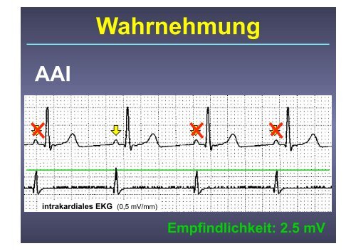 Herzschrittmacher: Basics und EKG-Workshop - Vivantes