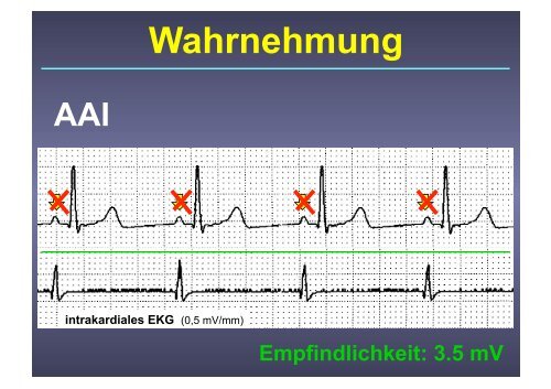 Herzschrittmacher: Basics und EKG-Workshop - Vivantes