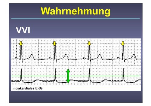 Herzschrittmacher: Basics und EKG-Workshop - Vivantes