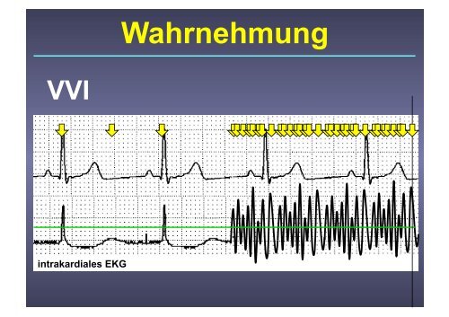 Herzschrittmacher: Basics und EKG-Workshop - Vivantes