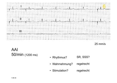 Herzschrittmacher: Basics und EKG-Workshop - Vivantes