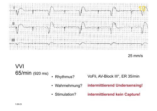 Herzschrittmacher: Basics und EKG-Workshop - Vivantes