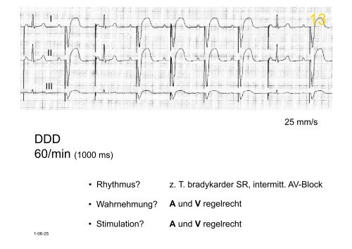 Herzschrittmacher: Basics und EKG-Workshop - Vivantes