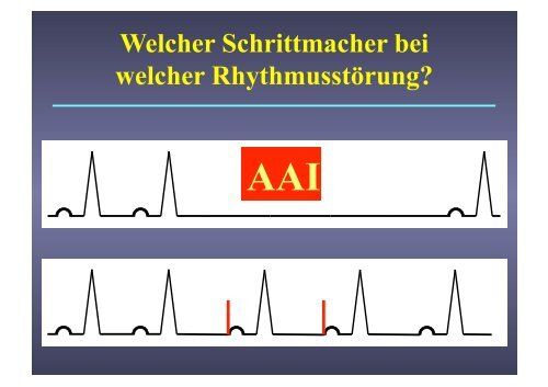 Herzschrittmacher: Basics und EKG-Workshop - Vivantes