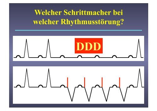 Herzschrittmacher: Basics und EKG-Workshop - Vivantes