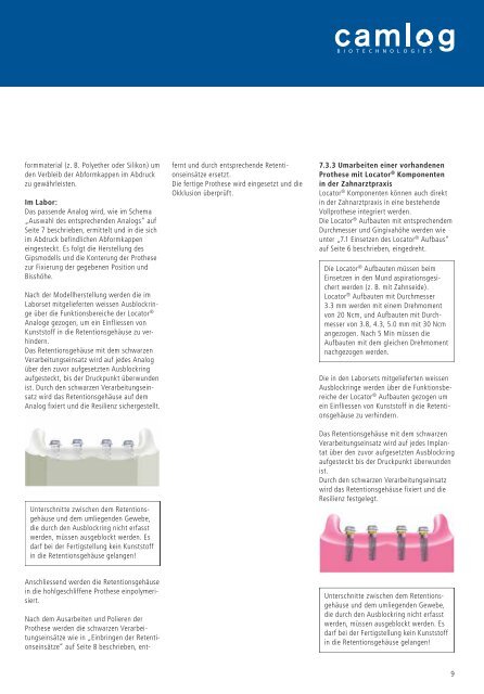 Arbeitsanleitung fÃ¼r das Locator Â® Verankerungssystem - Alltec Dental