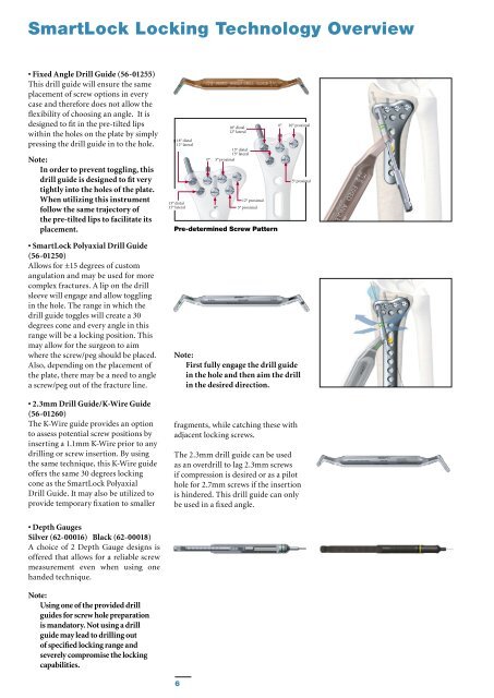 VariAxDistal Radius Locking Plate System - Stryker