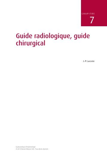 Guide radiologique, guide chirurgical - Decitre