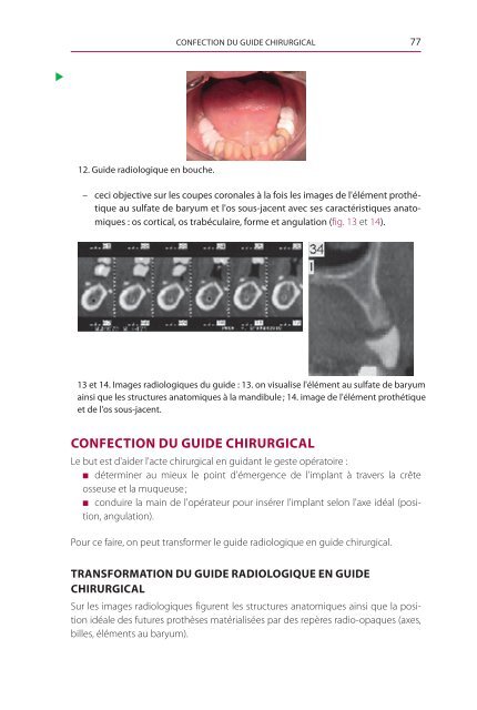 Guide radiologique, guide chirurgical - Decitre