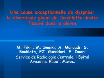 le diverticule gÃ©ant de l'oreillette droite fissurÃ© dans la plÃ¨vre