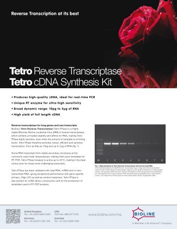 Tetro Reverse Transcriptase Tetro cDNA Synthesis Kit